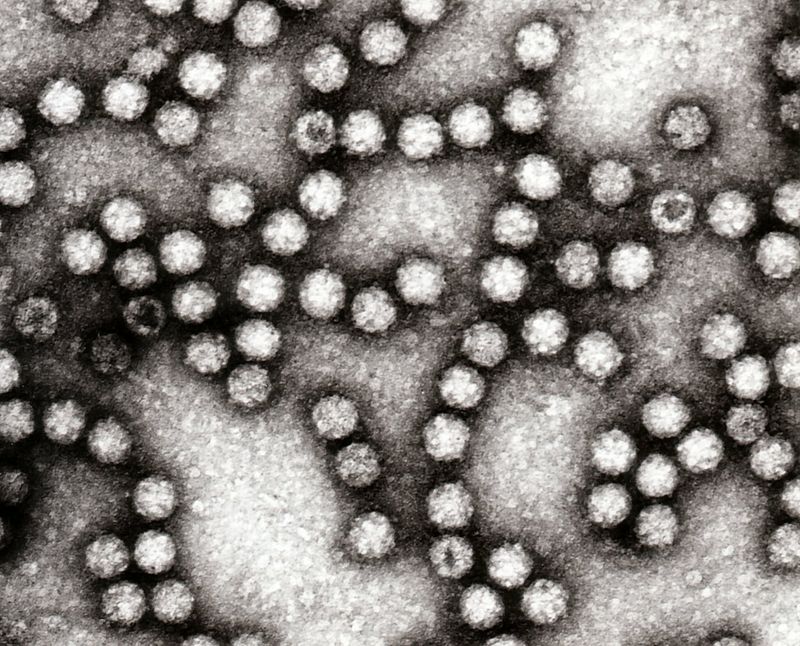 Astrovirus 4.jpg
