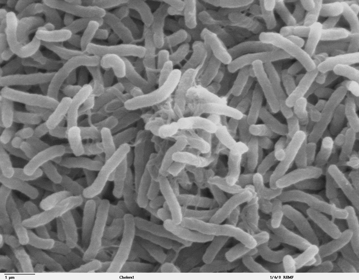 https://medde.org/wp-content/uploads/2020/11/Cholera_bacteria_SEM.jpg