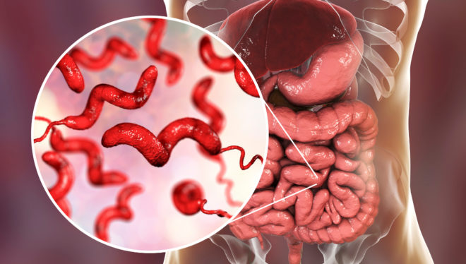 Campylobacter-Infektion: Symptome und Behandlung
