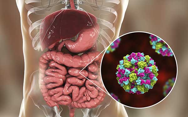 Norovirus-Infektion: Symptome, Behandlung und Prävention Norovirus-Infektion: Symptome, Behandlung und Prävention