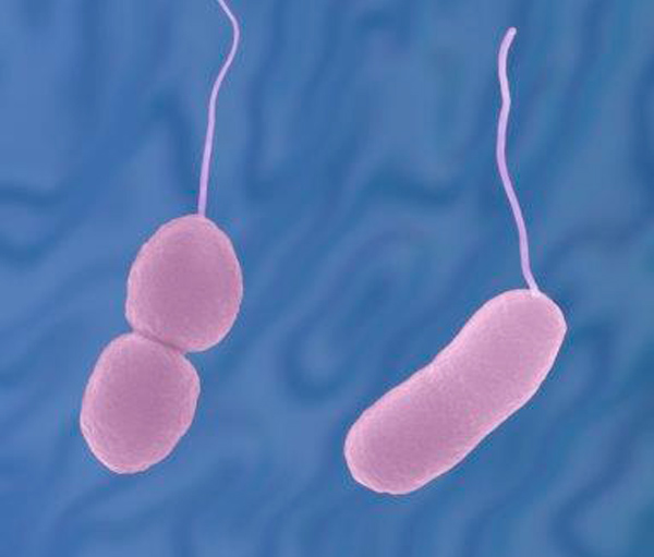 Was ist Vibrio parahaemolyticus?