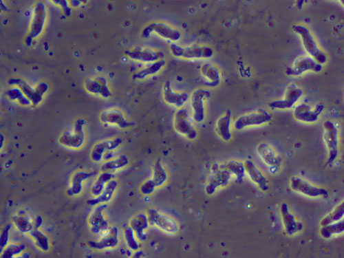 Naegleria fowleri-Infektion (gehirnfressende Amöbe) Naegleria fowleri-Infektion (gehirnfressende Amöbe)