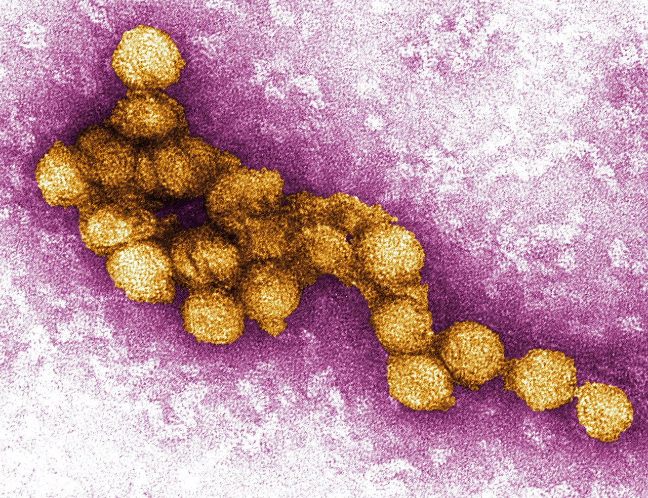 West-Nil-Virus: Symptome und Behandlung