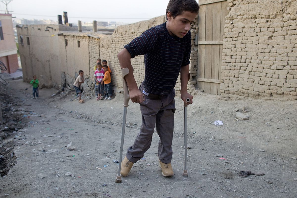 Polio: Ursachen, Symptome und Behandlung