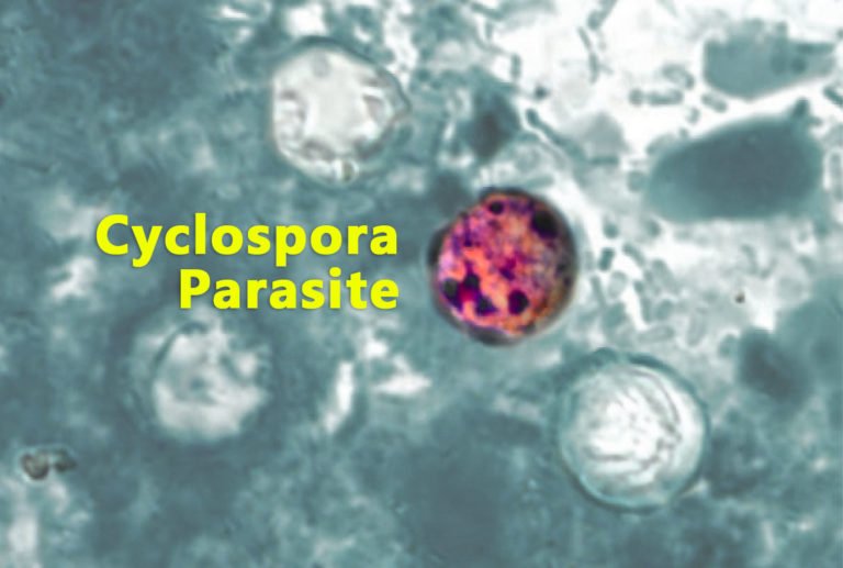 Cyclospora-Infektion: Symptome, Ursachen und Behandlung Cyclospora-Infektion: Symptome, Ursachen und Behandlung