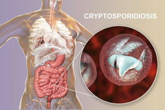 Cryptosporidium-Infektion: Symptome und Behandlung