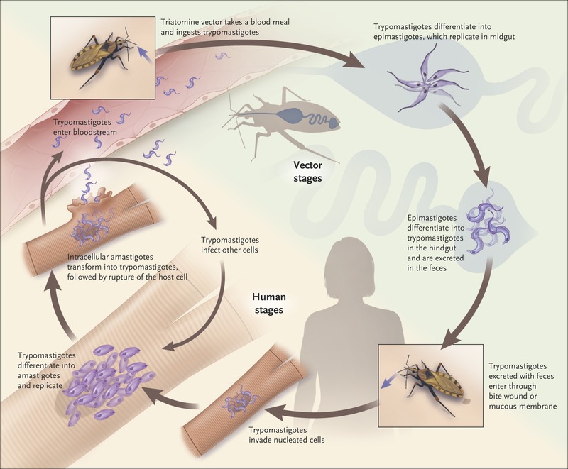 https://medde.org/wp-content/uploads/2021/01/nejmra1410150_f1.jpeg